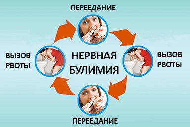 Лечение булимии в Серафимовском